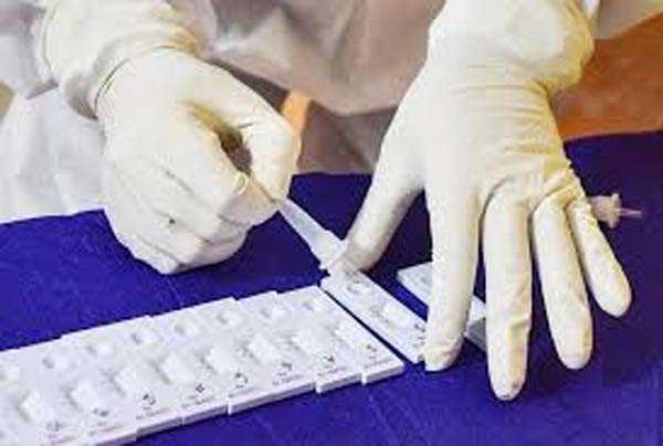 विश्व में कोरोना संक्रमितों की संख्या 2.02 करोड़ के पार